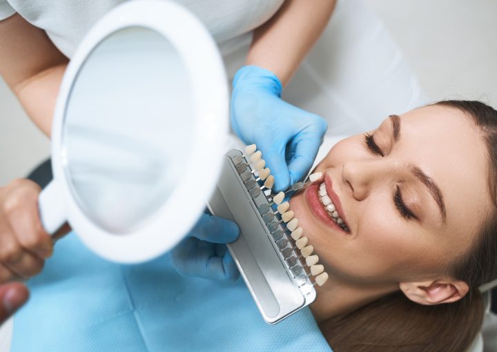 3 ventajas del blanqueamiento dental