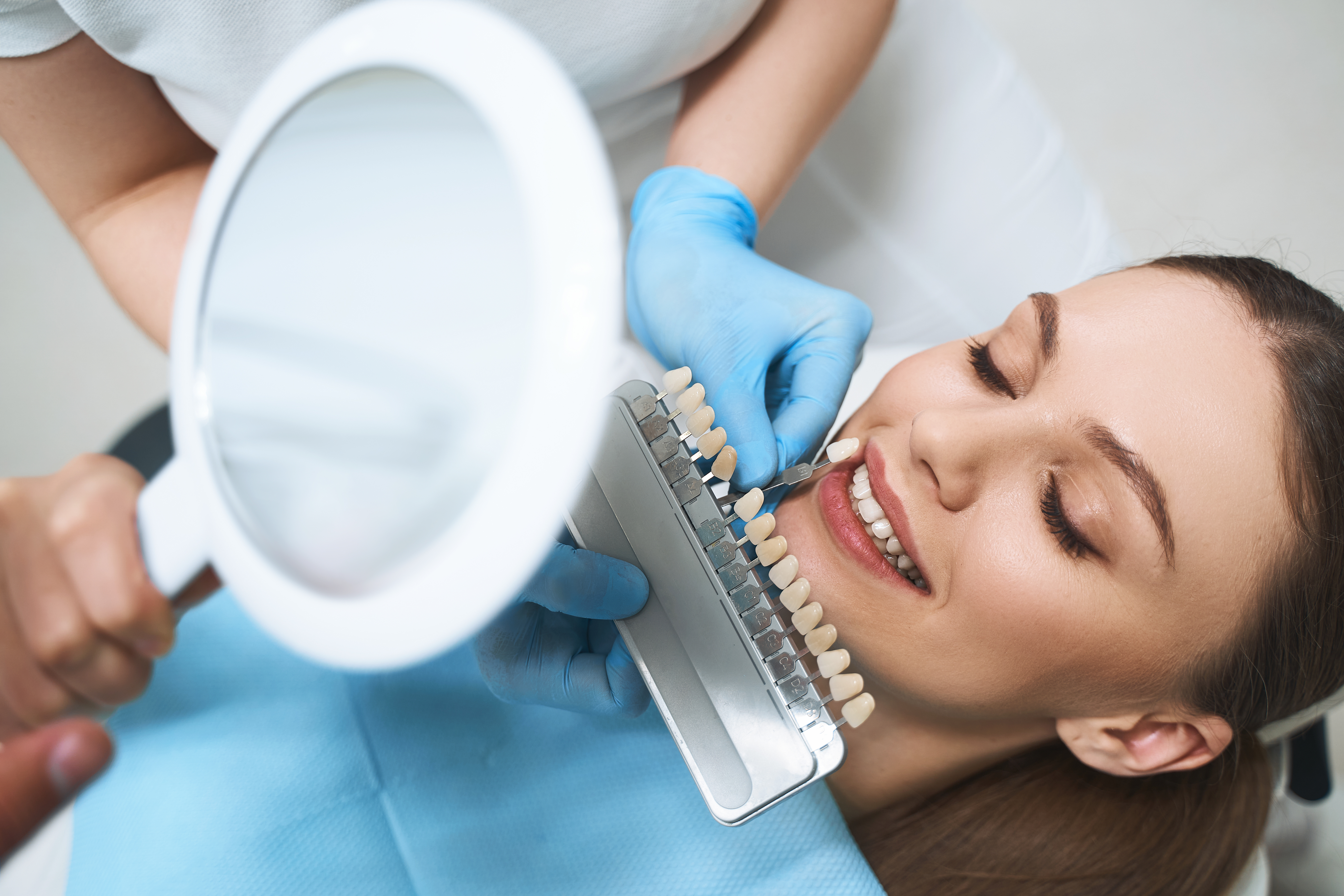 3 ventajas del blanqueamiento dental