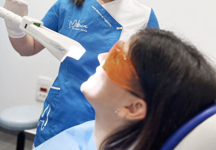 blanqueamiento dental pola de siero